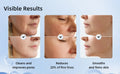 Visible results of facial treatment showing cleaned pores, reduced fine lines, and smoothed skin.