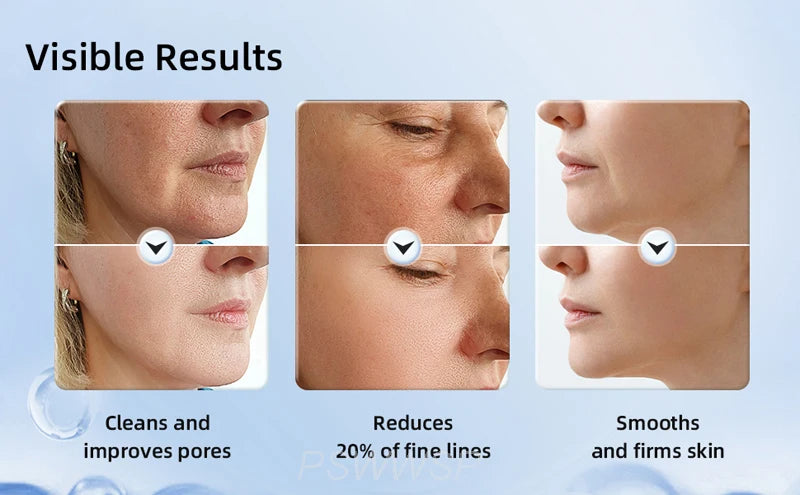 Visible results of facial treatment showing cleaned pores, reduced fine lines, and smoothed skin.